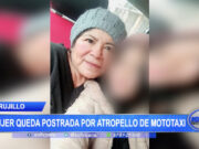 Trujillo: Mujer queda postrada en cama tras ser atropellada