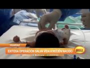 Huaraz: Exitosa operación salva vida a recién nacido