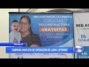 Trujillo: Realizarán campaña gratuita de operación de labio leporino