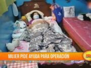 Trujillo: Mujer pide ayuda para operación tras sufrir fractura de rodilla