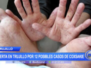 Alerta en Trujillo por doce posibles casos de Coxsakie
