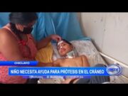 Chiclayo: Niño necesita ayuda para prótesis en el gránfo