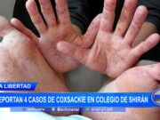 La Libertad: reportan 4 casos de Coxsackie en colegio de Shirán