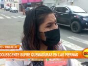 Adolescente sufre quemaduras en las piernas y su madre pide ayuda