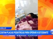 Trujillo: necesitan placas pediátricas para operar a estudiante