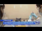 Lambayeque: Dos posibles casos de viruela del mono en la región