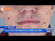 La Libertad: Once casos confirmados de la viruela del mono
