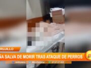 Trujillo: niña se salva de morir tras ataque de perros