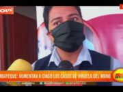 Lambayeque: aumentan a cinco los casos de viruela del mono en la región