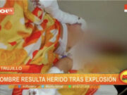 Trujillo: hombre resulta herido tras explosión por fuga de gas