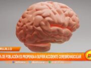 Trujillo: 40% de población es propensa a sufrir accidente cerebrovascular
