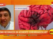 ¿Cómo reconocer un accidente cerebrovascular?