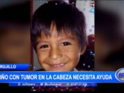 Trujillo: niño con tumor en la cabeza necesita ayuda