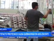 Chiclayo: artefacto pirotécnico causa quemadoras en adolescente