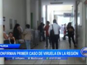 Piura: confirman primer caso de viruela en la región
