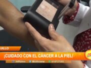 Trujillo: ¡cuidado con el cáncer a la piel!