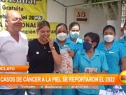 Chiclayo: 200 casos de cáncer a la piel se reportaron el 2022