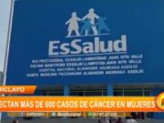 Lambayeque: hospitales detectan más de 600 casos de cáncer en mujeres