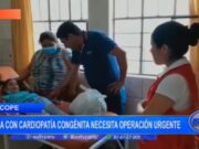 Ascope: niña con cardiopatía congénita necesita operación urgente