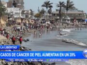 La Libertad: casos de cáncer de piel aumentan en un 20%