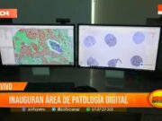 Trujillo: inauguran área de patología digital