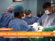 Cajamarca: Hospital Regional reinicia operaciones al corazón