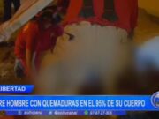 La Libertad: ¡Hombre Muere en Chepén por Quemaduras Graves en el 95% de su Cuerpo!