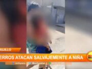 Trujillo: perros atacan salvajemente a niña
