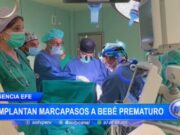 Internacional: Cardiólogos europeos implantan marcapasos en bebé prematuro