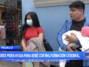 Padres Solicitan Ayuda para Bebé con Hidranencefalia en Perú