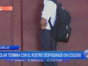 Trujillo: escolar termina con el rostro desfigurado en colegio