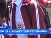 Estudiante agredido en colegio recibe apoyo financiero y se recupera sin complicaciones