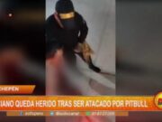 La Libertad: anciano queda herido tras ser atacado por pitbull