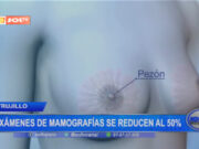Trujillo: exámenes de mamografías se reducen al 50%