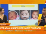 Inicia campaña para operar niños con labio fisurado