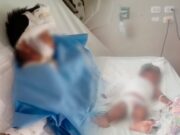 La Libertad: niño de 4 años sufre graves quemaduras y necesita apoyo