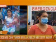 Trujillo: adolescente con tumor en la cabeza necesita ayuda