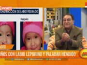 Trujillo: niños con labio leporino y paladar hendido