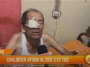 Trujillo: hombre con piernas amputadas necesita ayuda