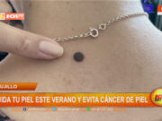 La Libertad: cuida tu piel este verano y evita cáncer de piel