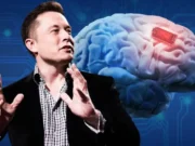 Neuralink implanta el primer chip cerebral en un ser humano