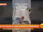 Niño con cáncer de hueso en riesgo de perder brazo