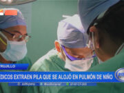 Trujillo: salvan la vida a niño de 4 años que tenía una pila en el pulmón