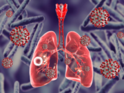 24 de marzo: Día Mundial de la Tuberculosis