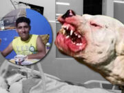 Hombre queda en coma tras ser atacado por perros pitbull