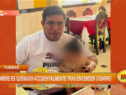 Tumbes: hombre es quemado accidentalmente tras encender cigarro