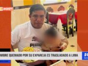 Tumbes: hombre quemado por su expareja es trasladado a Lima