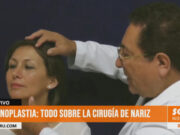 Rinoplastia: todo sobre la cirugía de nariz