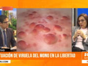 Alerta por viruela del mono en La Libertad: nuevos casos y medidas urgentes