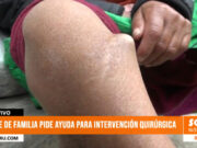 Madre de familia en Trujillo pide ayuda urgente para cirugía por accidente